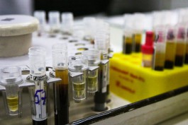 Частная лаборатория начала делать тесты на антитела к коронавирусу в Калининграде 