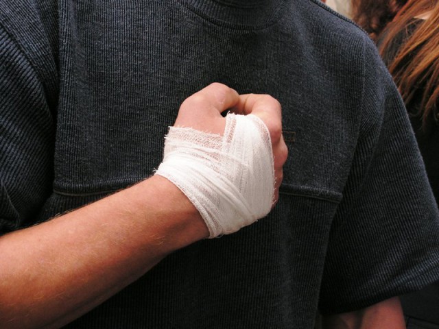 УМВД: Житель Гвардейска палкой сломал челюсть 32-летнему мужчине