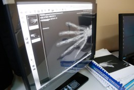 В шесть больниц Калининградской области поставят новые рентген-аппараты за 156 млн рублей