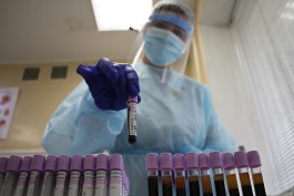 «Нежданные антитела»: калининградцы начали получать результаты тестов на иммунитет к коронавирусу