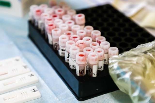 Роспотребнадзор объявил пятый этап исследований на антитела к коронавирусу в регионе