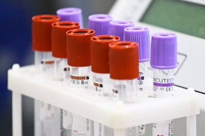 За сутки в Калининградской области выявили 128 случаев коронавируса