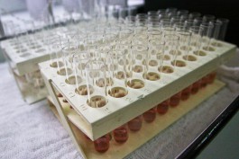 В калининградском Роспотребнадзоре объяснили появление отрицательных тестов на коронавирус у больных людей