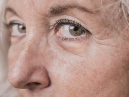 Синдром уставшего лица: из-за чего мы выглядим значительно старше своего возраста