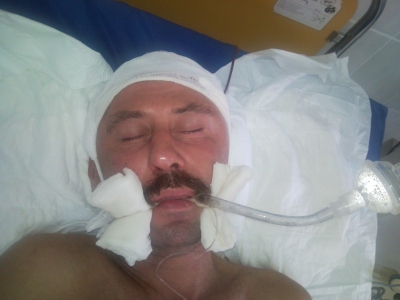 Региональное УВД просит калининградцев помочь установить личность пострадавшего мужчины