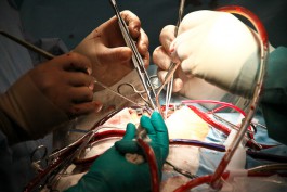 За год врачи калининградского кардиоцентра провели 3600 операций