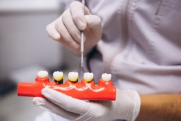 Имплант зуба &mdash; как выбрать, чтобы не ошибиться